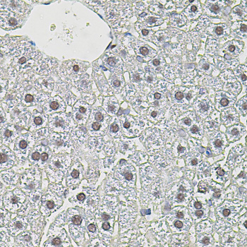 Immunohistochemistry of paraffin-embedded Mouse liver using MYC Polyclonal Antibody at dilution of 1:100 (40x lens).