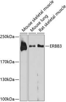 Western blot analysis of extracts of various cell lines using ERBB3 Polyclonal Antibody at dilution of 1:1000.