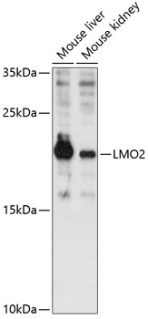 Western blot analysis of extracts of various cell lines using LMO2 Polyclonal Antibody at 1:3000 dilution.