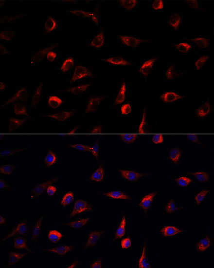 Immunofluorescence analysis of L929 cells using MAP2K7 Polyclonal Antibody at dilution of  1:100. Blue: DAPI for nuclear staining.