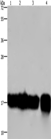 Western Blot analysis of A549 and K562 cell, Raji cell and Human fetal intestine tissue using IL17C Polyclonal Antibody at dilution of 1:300