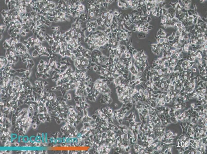 OE19 Cell Complete Medium - 2