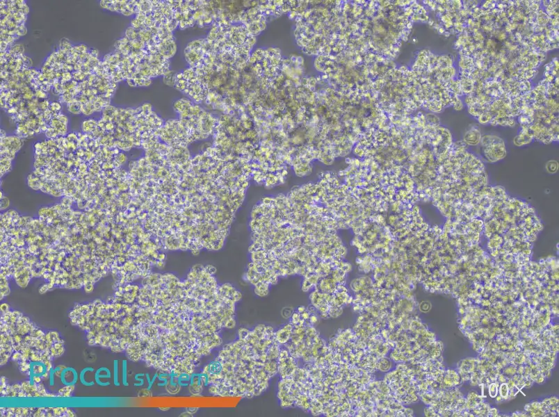 NCI-H187 Cell Complete MediumNCI-H187 Cell Complete Medium - 2