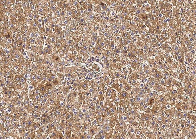 Transferrin/TF Monoclonal Antibody - 1