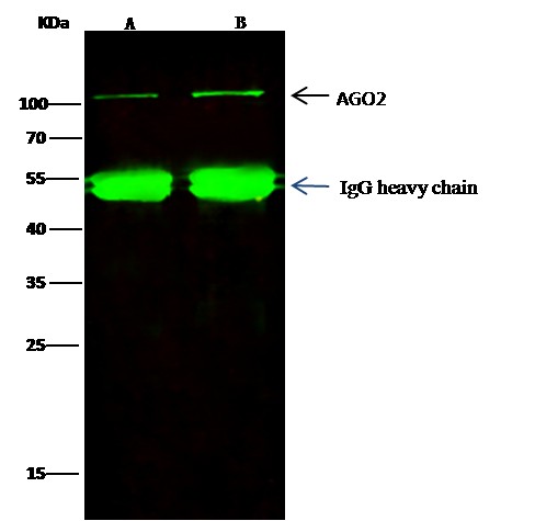 Recombinant AGO2/Argonaute 2/EIF2C2 Monoclonal Antibody - small - 4