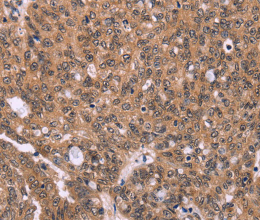 ERAS Polyclonal Antibody - 3