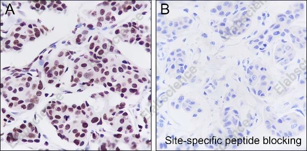 Recombinant JunB Monoclonal Antibody - 1