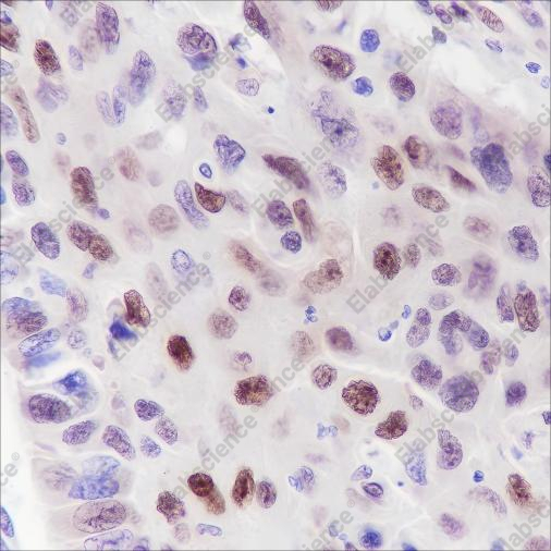 Recombinant Cyclin D3 Monoclonal Antibody - 4