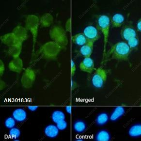 Recombinant Ret Monoclonal Antibody - 1