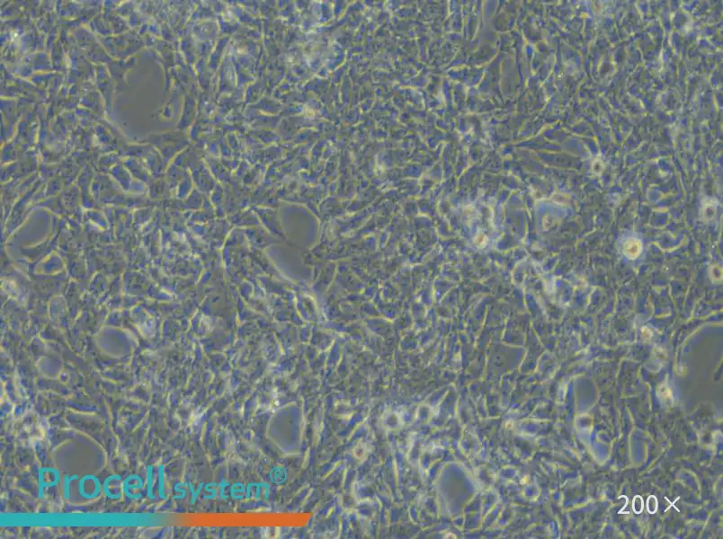 SBC-3 Cell Complete Medium - small - 5