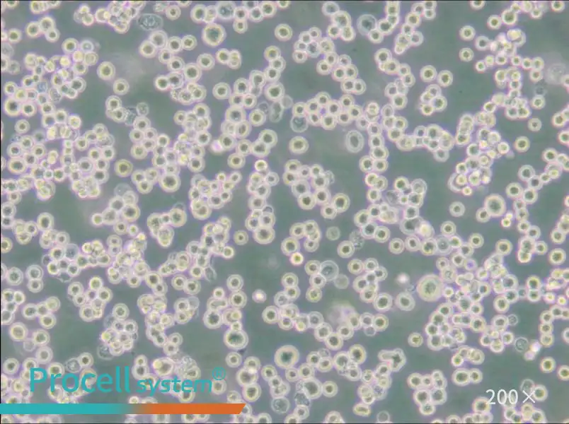 LLC-WRC 256 [Walker 256] Cell Complete Medium - 5