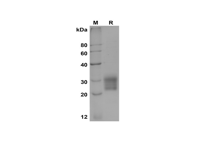 Recombinant Mouse IL-33 Protein(Trx Tag)-产品推荐-1