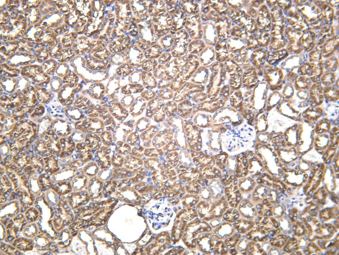 Recombinant NCPR Monoclonal Antibody - 3