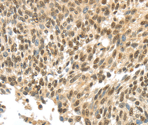 Immunohistochemistry of paraffin-embedded Human tonsil tissue using APOL6 Polyclonal Antibody at dilution 1:60