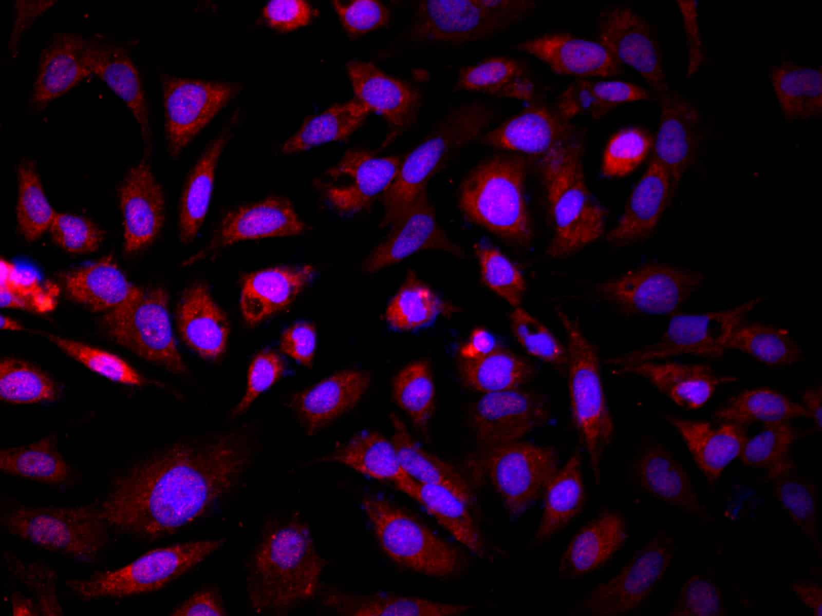 Purified Anti-Human CD134 Antibody[Ber-ACT35]-产品推荐-1