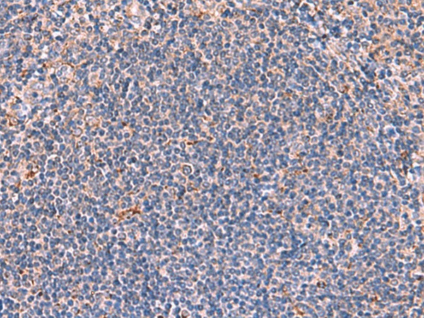 Immunohistochemistry of paraffin-embedded Human tonsil tissue  using FDXR Polyclonal Antibody at dilution of 1:85(?200)