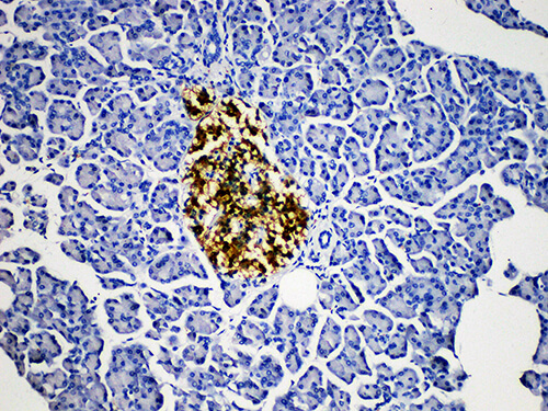 Immunohistochemistry of paraffinembedded Human pancreatic tissue with Protein Gene Product 9.5(PGP 9.5) Monoclonal Antibody(Antigen repaired by EDTA).