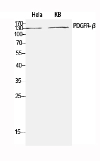 Western Blot analysis of Hela, KB cells using PDGFRB Polyclonal Antibody at dilution of 1:1000.