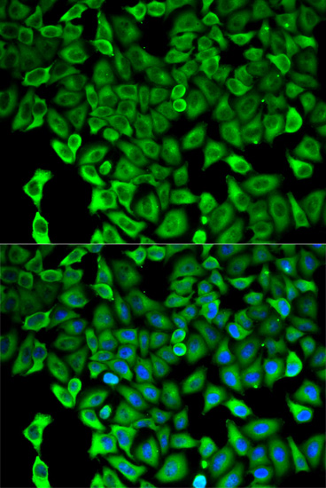 Immunofluorescence analysis of HeLa cells using PSMD2 Polyclonal Antibody Blue: DAPI for nuclear staining.