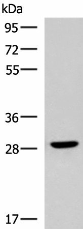 Western blot analysis of Human fetal brain tissue lysate  using CLEC9A Polyclonal Antibody at dilution of 1:800