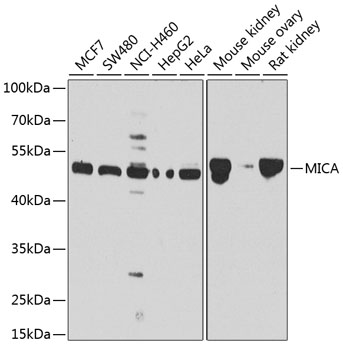 Western blot analysis of extracts of various cell lines using MICA Polyclonal Antibody at dilution of 1:1000.