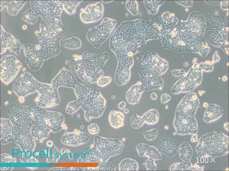 NCI-H1944 Cell Complete Medium - 2