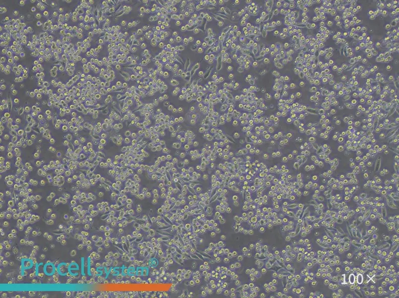 P815 Cell Complete MediumP815 Cell Complete Medium - 2