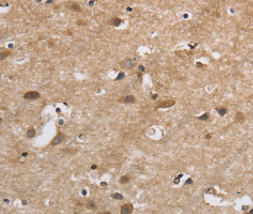 SDCCAG3 Polyclonal Antibody - 3