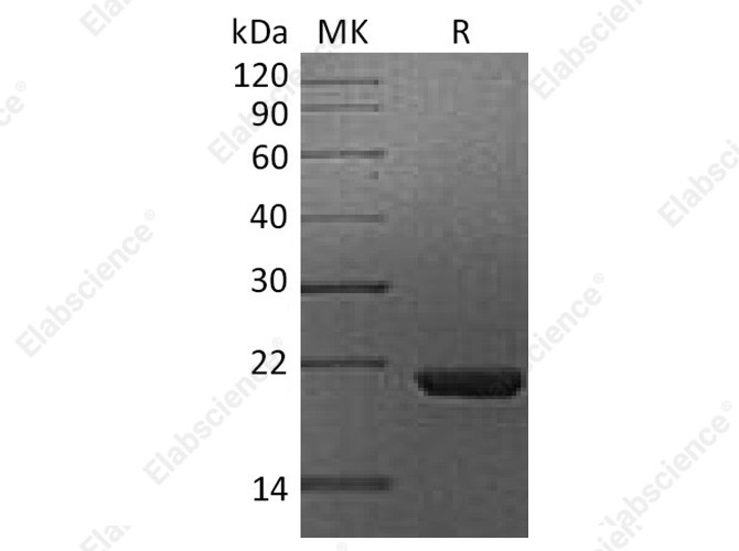 Recombinant Human Cyclophilin B/PPIB Protein (His Tag) - 1