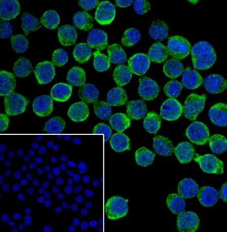 Recombinant IKB beta Monoclonal Antibody - small - 3