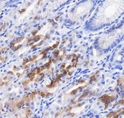 Recombinant Gastric Mucin-6/MUC6 Monoclonal Antibody-searchlist-1