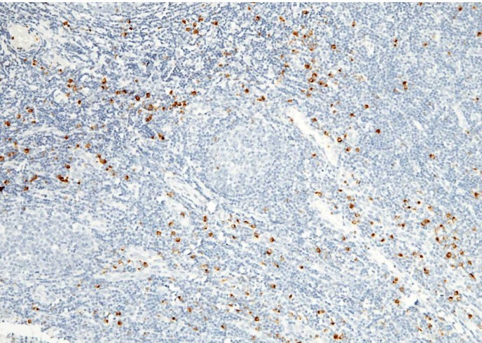 Recombinant Granzyme B/GZMB Monoclonal Antibody-searchlist-1