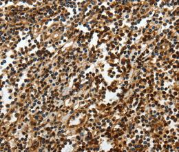 SOX-13 Polyclonal Antibody - 2