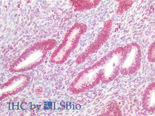 Immunohistochemistry of paraffin-embedded Human uterus using Lamin B1 Polyclonal Antibody at dilution of 1:100(Elabscience Product Detected by Lifespan).