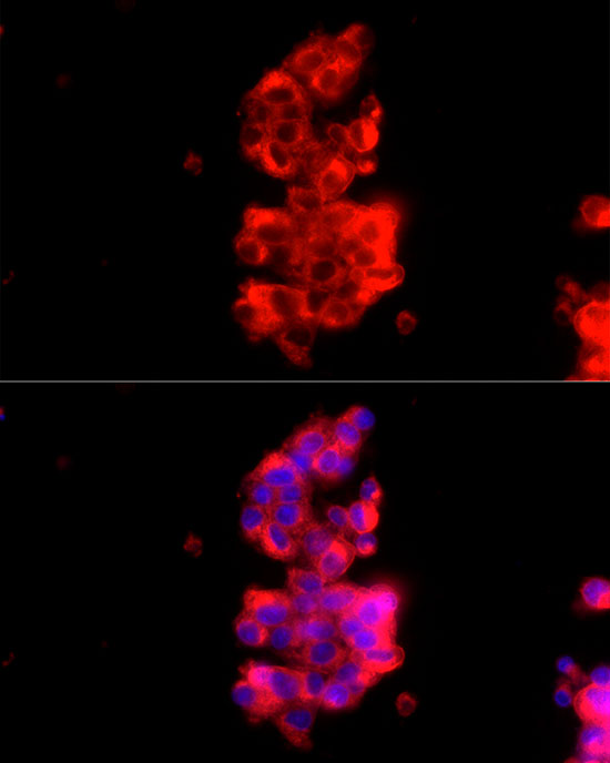 Immunofluorescence analysis of HepG2 cells using [KD Validated] RAB27A Polyclonal Antibody at dilution of 1:150 (40x lens). Blue: DAPI for nuclear staining.