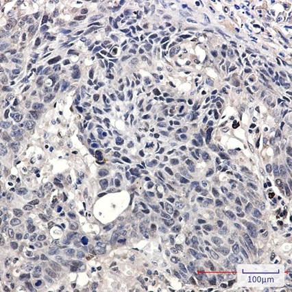 Recombinant SMARCA2/BRM Monoclonal Antibody - 2