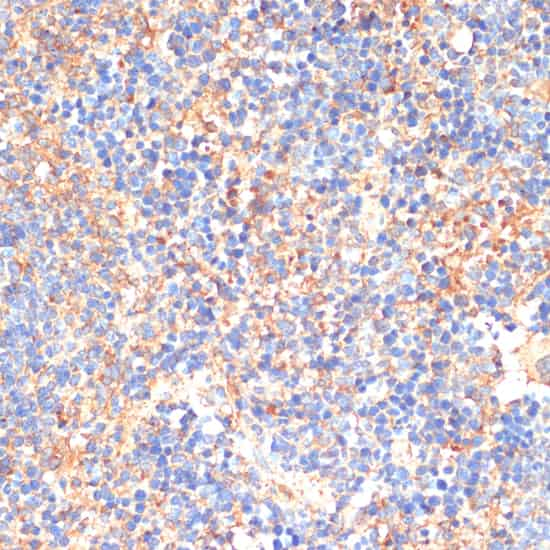 Immunohistochemistry of paraffin-embedded Mouse spleen using SIGLEC3/CD33 Polyclonal Antibody at dilution of  1:200 (40x lens).