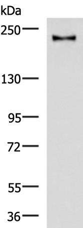 Western blot analysis of Mouse brain tissue lysate  using KIF21B Polyclonal Antibody at dilution of 1:1000