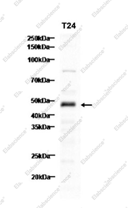 Recombinant AP2 alpha Monoclonal Antibody - 1