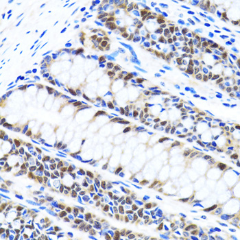 Immunohistochemistry of paraffin-embedded Human colon using UHRF1 Polyclonal Antibody at dilution of  1:100 (40x lens).