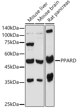 Western blot analysis of extracts of various cell lines using PPARD Polyclonal Antibody at 1:1000 dilution.