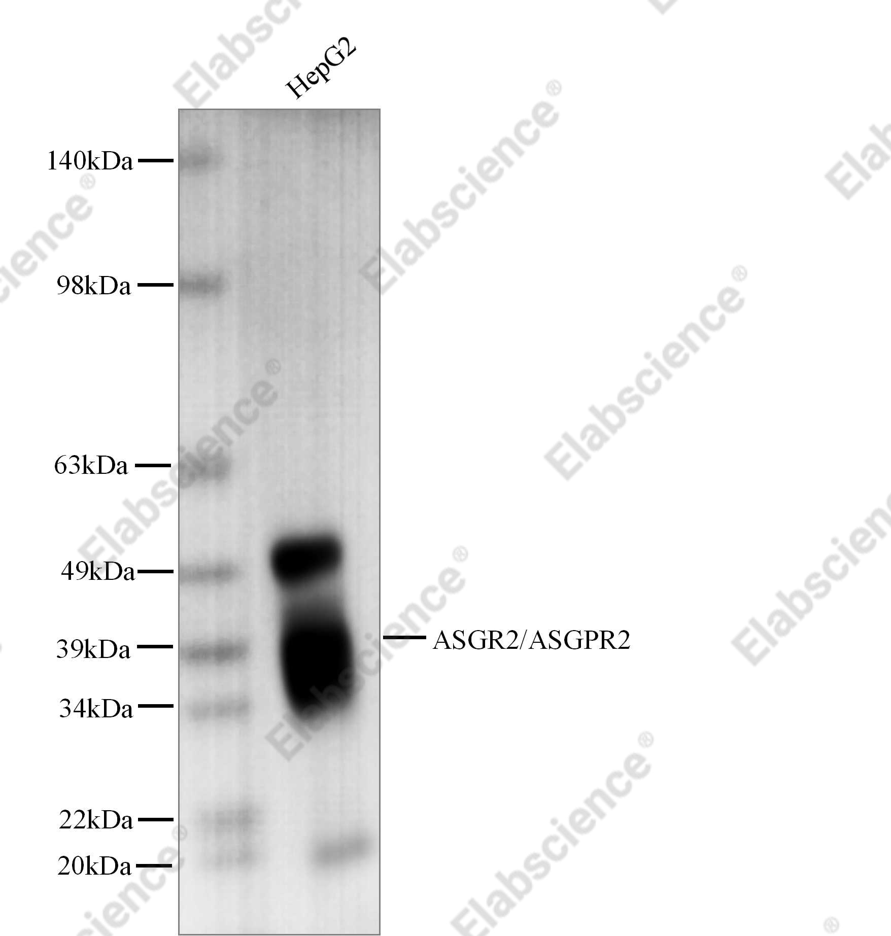 Recombinant ASGR2/ASGPR2 Monoclonal Antibody - 1