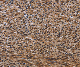 KIF1C Polyclonal Antibody - 3