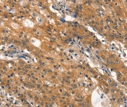 DNM2 Polyclonal Antibody - 2