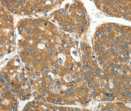 RPLP0 Polyclonal Antibody - 2