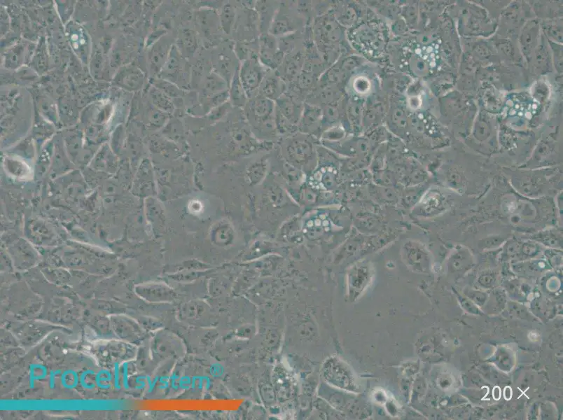 NCI-H1666 Cell Complete Medium - 6