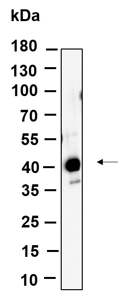 Recombinant FBX32 Monoclonal Antibody-searchlist-1