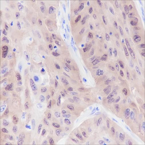 Recombinant ALDH3A1 Monoclonal Antibody - 3
