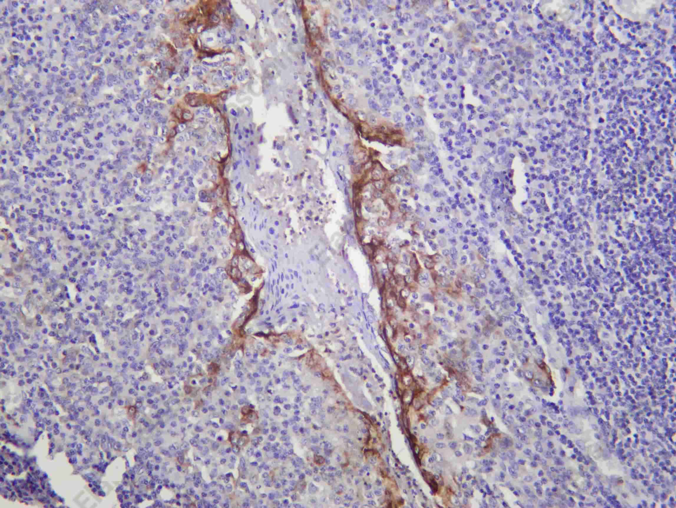 Recombinant MIP-3α Monoclonal Antibody - 1