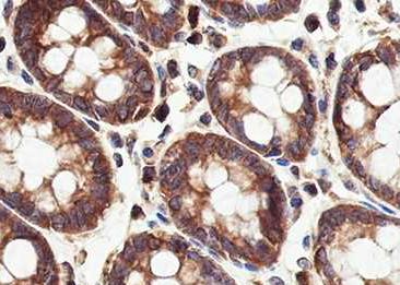 Recombinant PRDM4/PFM1 Monoclonal Antibody-searchlist-2
